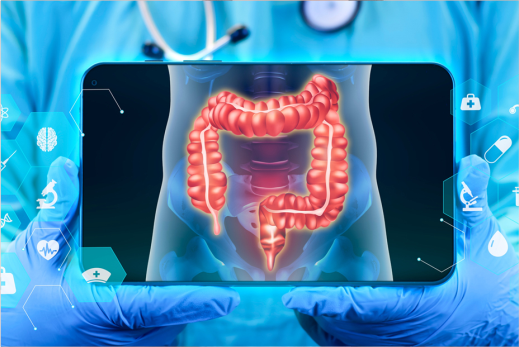 Retossigmoidoscopia_exame